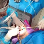 Implantologia w gabinecie
